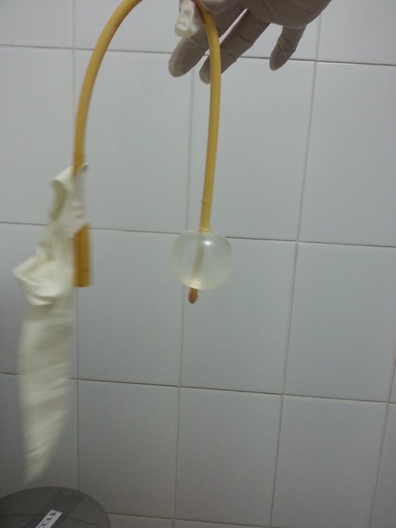 полный отчет. роды. фото.