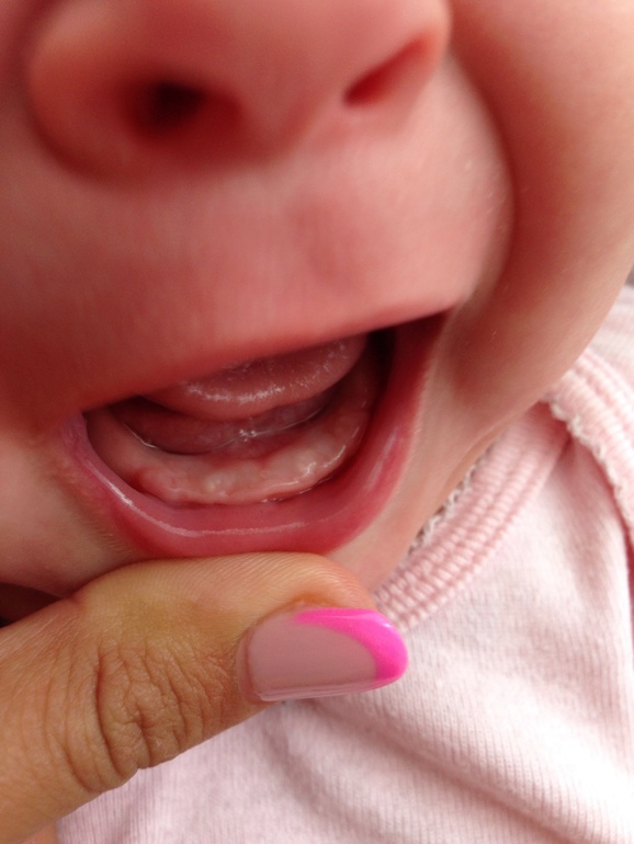 Банальный вопрос, зубы???