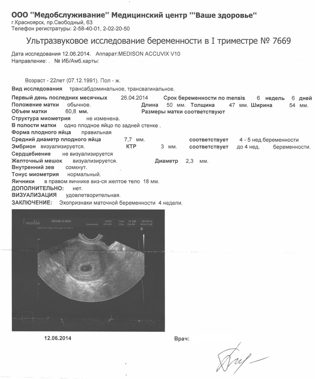 Фото Узи Беременности 3 Недели С Заключением