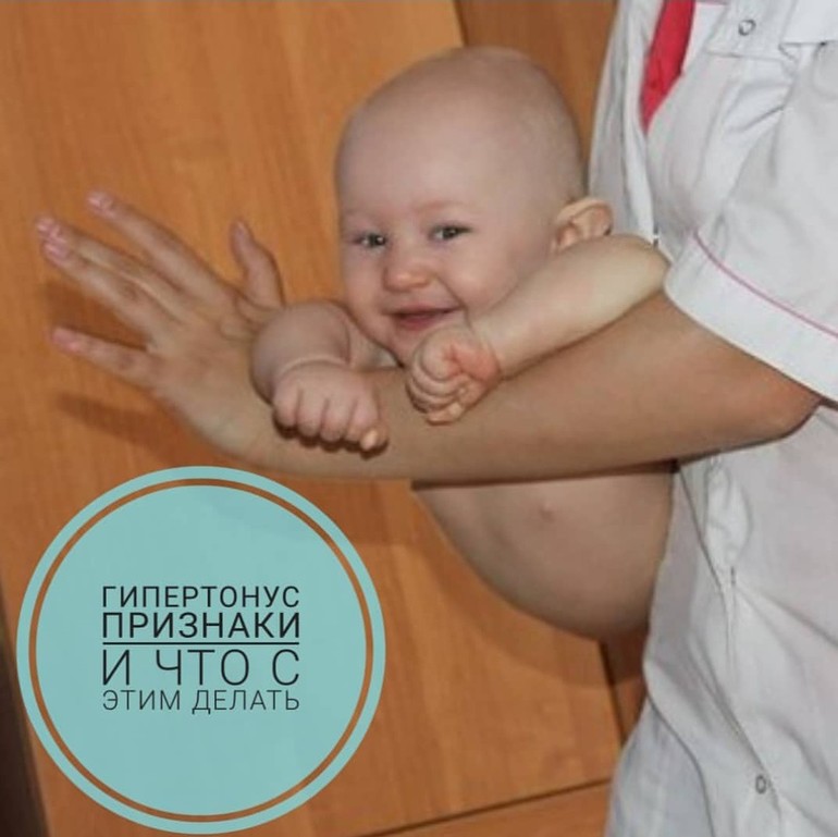 Педиатр из Узбекистана рассказал, когда запрокидывание головы малыша во сне не является нормой