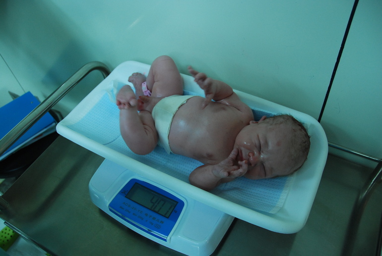 Мои роды ПКС в Китае г. Пекин