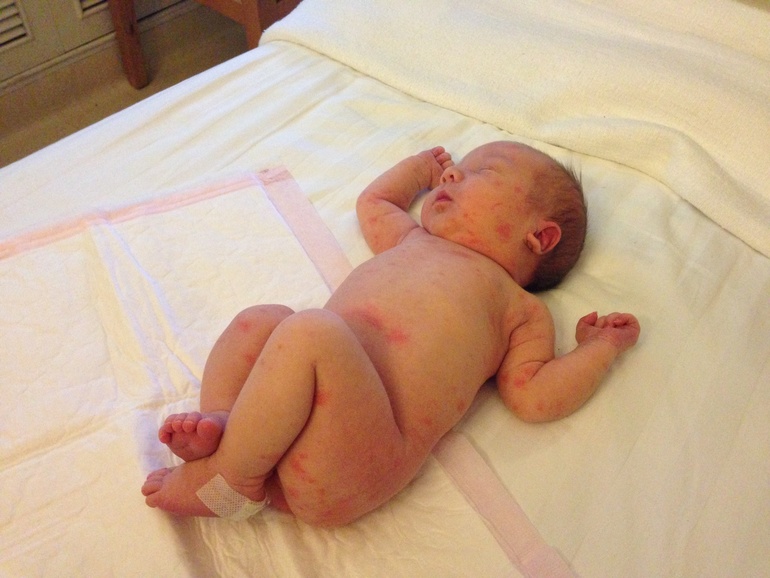 Мои роды ПКС в Китае г. Пекин