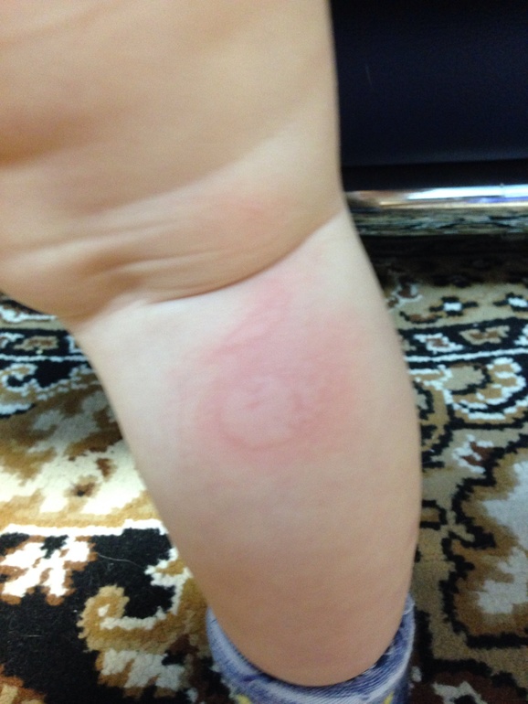 Девочки, что этооо???