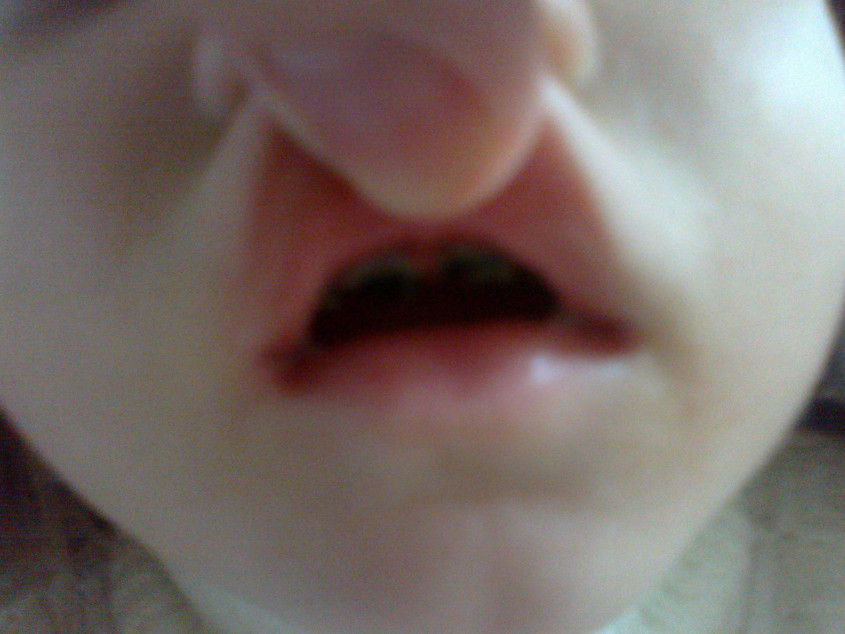 Спасти зубки