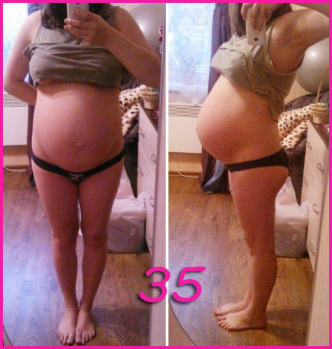 35