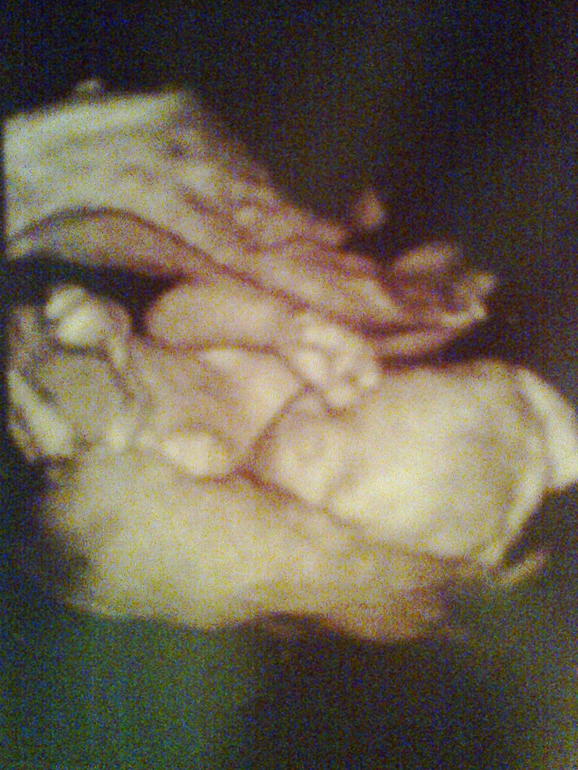 Экватор! 4 Д узи, про соответствие снам и приметам полу малыша...