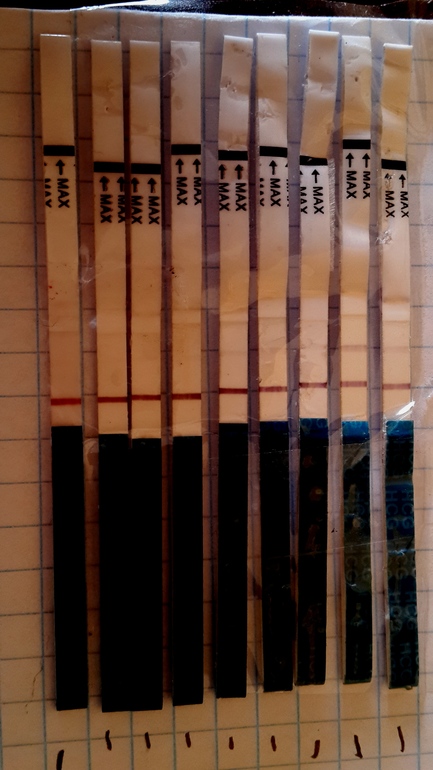 Фолликулярная киста...