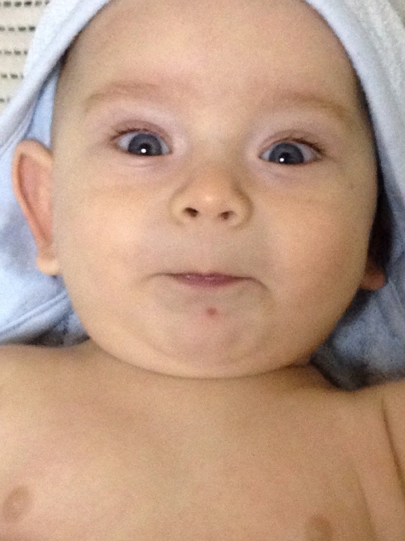 Девочки помогите, долго не проходит прыщ у ребенка