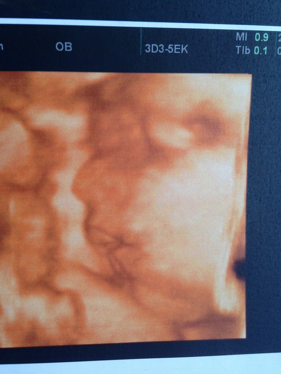 Были в ЦИРе на узи:)